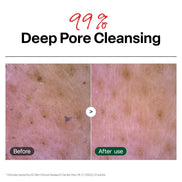 Ph Cleansing Gel Foam - Everyday Gentle Face Cleanser for All Skin Types - Ph-Balanced - Hydrating - Deep Pore Cleansing - Safe for Daily Use on Sensitive Skin - Korean Skincare - 6.76 Fl Oz