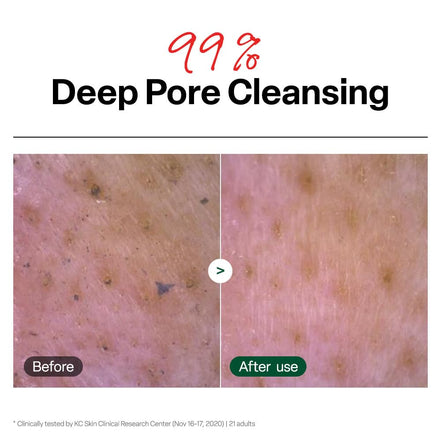Ph Cleansing Gel Foam - Everyday Gentle Face Cleanser for All Skin Types - Ph-Balanced - Hydrating - Deep Pore Cleansing - Safe for Daily Use on Sensitive Skin - Korean Skincare - 6.76 Fl Oz
