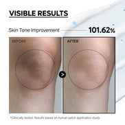 Transform Your Skin with TX Capsule Body Cream – 99% Pure Tranexamic Acid & Niacinamide for Brightening Dark Spots, Uneven Tone & Dullness | Luxurious Non-Greasy Body Lotion for Radiant Skin