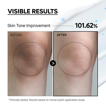 Transform Your Skin with TX Capsule Body Cream – 99% Pure Tranexamic Acid & Niacinamide for Brightening Dark Spots, Uneven Tone & Dullness | Luxurious Non-Greasy Body Lotion for Radiant Skin