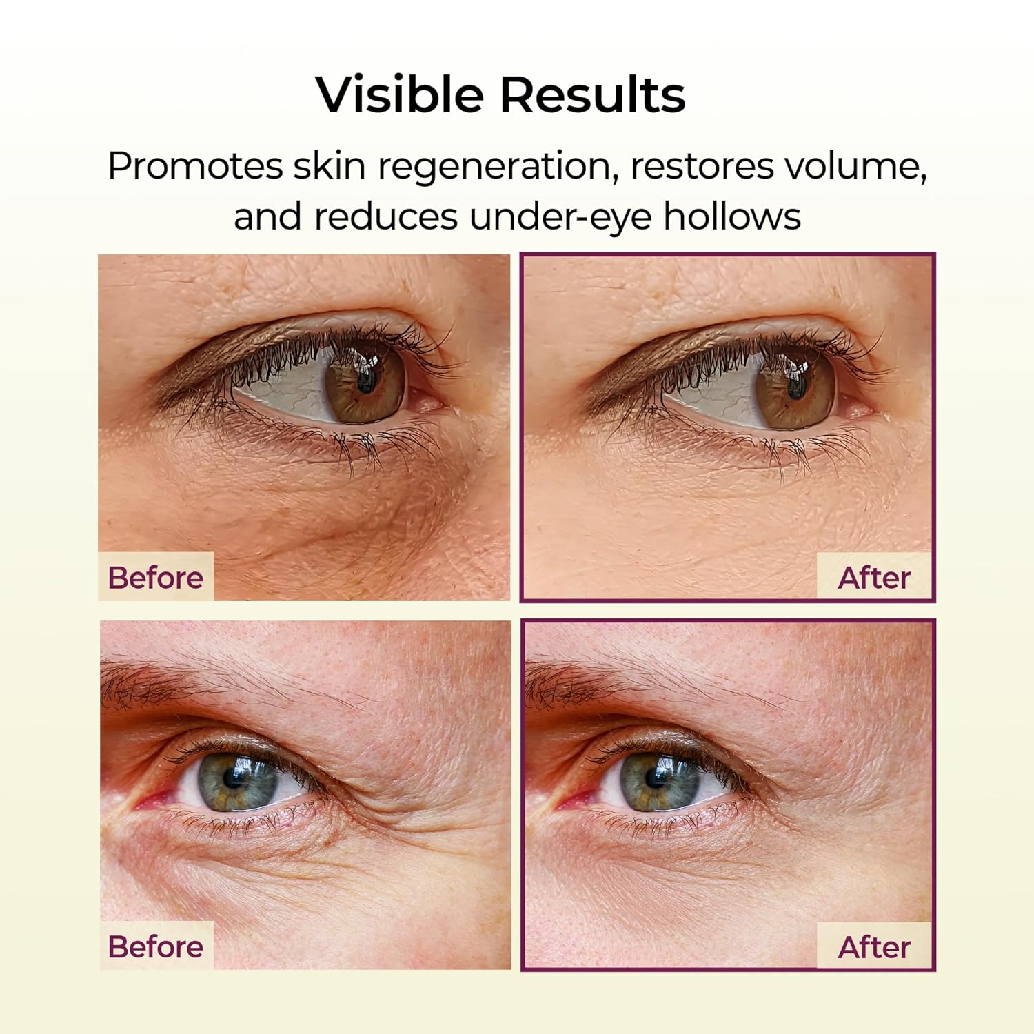 Revitalize Your Eyes with Dr. Melaxin Cemenrete Calcium Multi Balm - The Ultimate Eye Treatment for Youthful, Firm Skin
