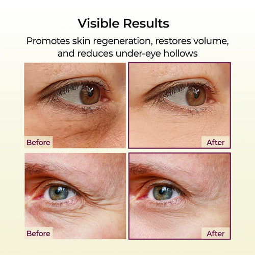 Revitalize Your Eyes with Dr. Melaxin Cemenrete Calcium Multi Balm - The Ultimate Eye Treatment for Youthful, Firm Skin